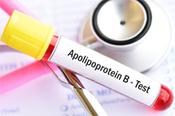 ApoB and Your Health: What You Need to Know 