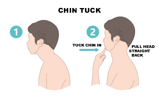 Chin Tuck
